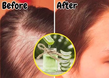 Aloe Vera for Hair Health: Miracle Remedy or Overrated Trend? Aloe Vera for Hair Health: Miracle Remedy or Overrated Trend?