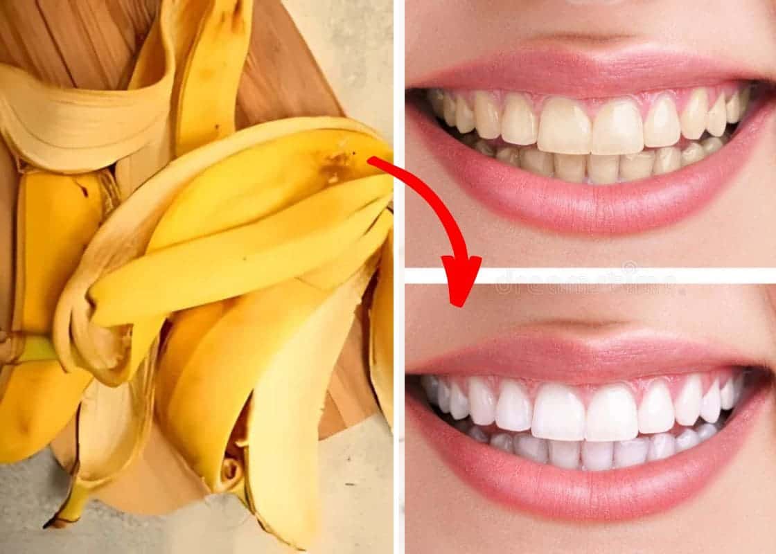 Don’t Toss Banana Peels If You Don’t Know How They Can Boost Your Wellness