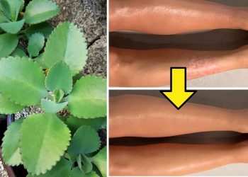 Top 9 Benefits of Kalanchoe For Your Overall Health