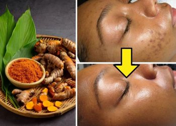 Top 10 Health Benefits of Turmeric for Digestion, Skin, and More