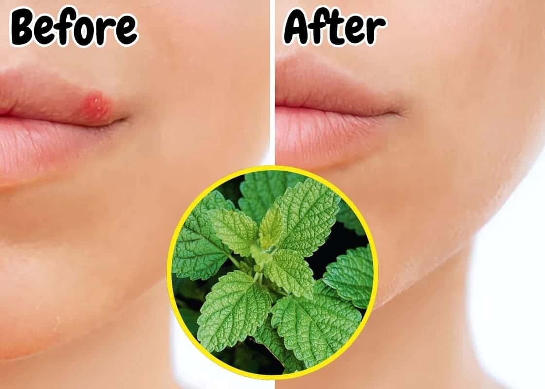 Top 9 Health Benefits of Lemon Balm And Effective Ways to Use It