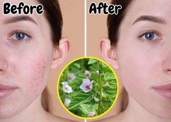 What Can the Marshmallow Plant Do for Your Health?