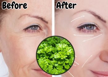 Can Parsley Truly Erase Wrinkles? Discover Its Surprising Anti-Aging and Health Benefits!