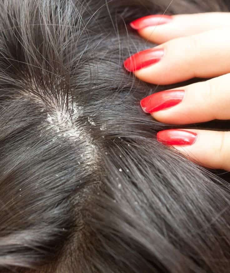 Aloe Vera for Hair Health: Miracle Remedy or Overrated Trend?