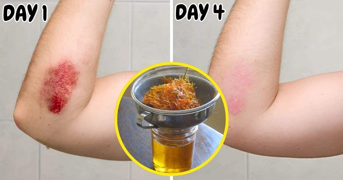 Top 10 Amazing Health Benefits Of Calendula As The Garden S Gift