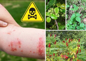 Beware of Poison Sumac, Poison Oak, and Poison Ivy – They Can Wreak Havoc on Your Skin!